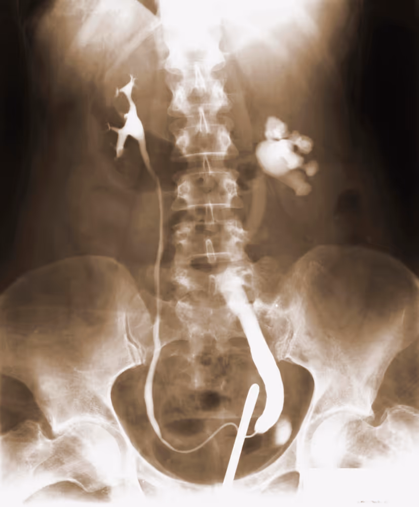 Prostate health and early cancer detection